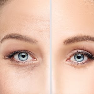 Woman's skin before and after skin treatment