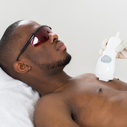 A man lying down getting laser hair removal